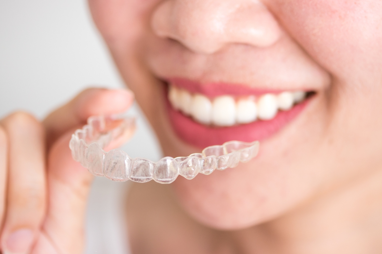 ¿Para quién es recomendable Invisalign y cuándo conviene usar brackets?