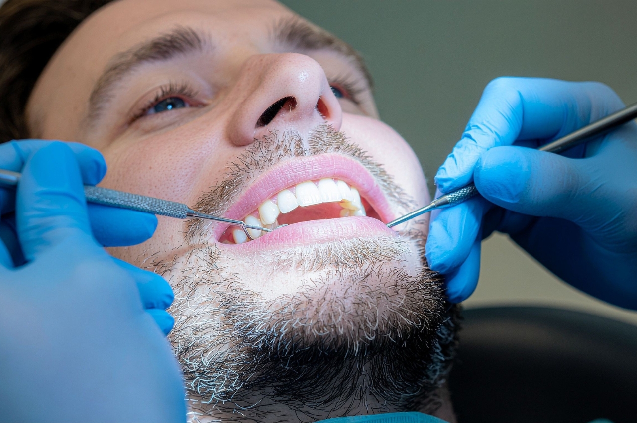 Implantes Dentales: La Solución Moderna para Recuperar tu Sonrisa